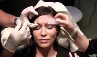 Here comes the   botox   bride