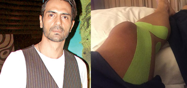 Arjun Rampal injures knee during Kahaani 2 shoot