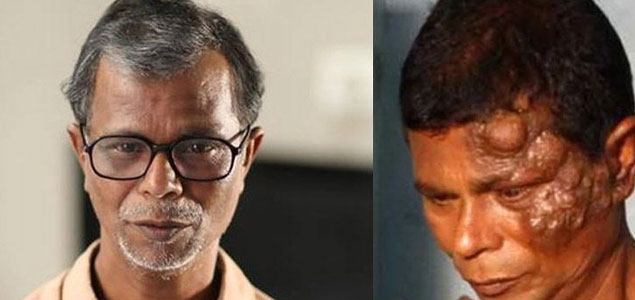 Indrans makeover