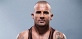 'Prison Break' star Dominic Purcell injured on set