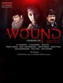 Click to know more about Wound