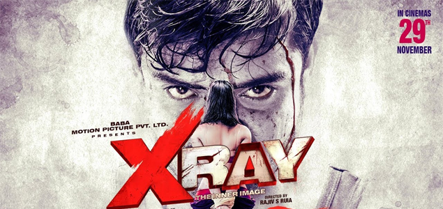 X RAY Hindi Movie